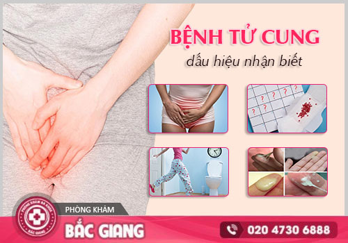 Cảnh báo sớm các bệnh tử cung thường gặp ở nữ giới