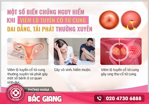 Cảnh báo sớm các bệnh tử cung thường gặp ở nữ giới